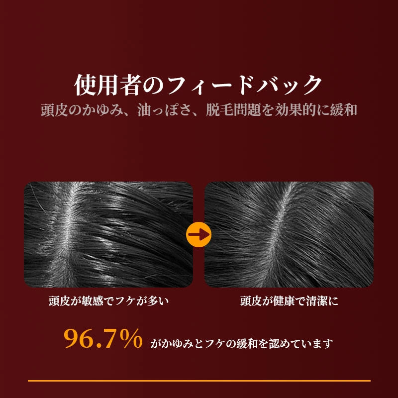 【電動頭皮ブラシ・5月新発売ランキング1位】Kizuna Store™ScalpTech LEDCare Pro