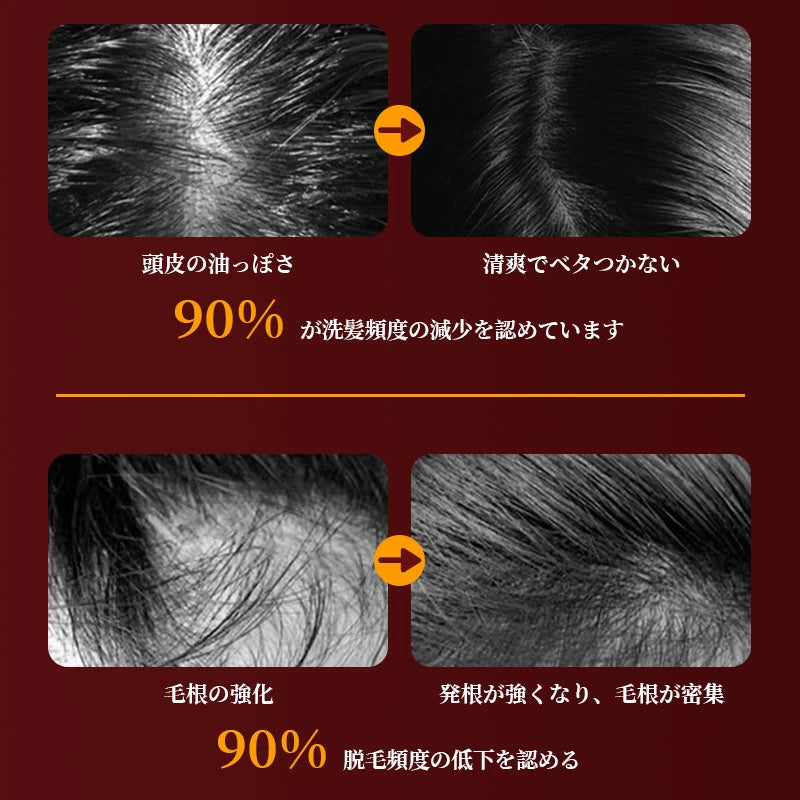 【電動頭皮ブラシ・5月新発売ランキング1位】Kizuna Store™ScalpTech LEDCare Pro